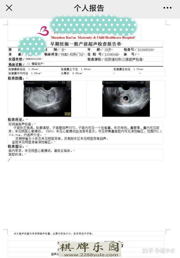 28岁第一次怀孕胎停记一次药流不需要清宫经历